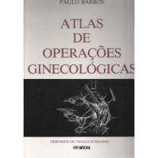 ATLAS DE OPERAÇÕES GINECOLÓGICAS