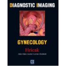 DIAGNOSTIC IMAGING - GYNECOLOGY