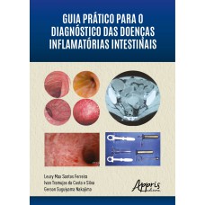 GUIA PRÁTICO PARA O DIAGNÓSTICO DAS DOENÇAS INFLAMATÓRIAS INTESTINAIS