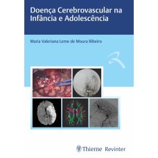 DOENÇA CEREBROVASCULAR NA INFÂNCIA E ADOLESCÊNCIA