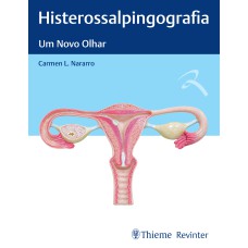 HISTEROSSALPINGOGRAFIA: UM NOVO OLHAR