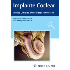 IMPLANTE COCLEAR: TÉCNICAS CIRÚRGICA EM REALIDADE AUMENTADA