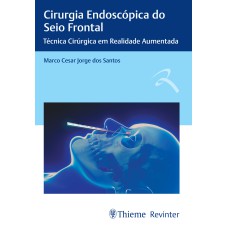 CIRURGIA ENDOSCÓPICA DO SEIO FRONTAL