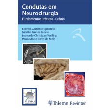 SBN CONDUTAS EM NEUROCIRURGIA: FUNDAMENTOS PRÁTICOS - CRÂNIO