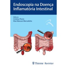 ENDOSCOPIA NA DOENÇA INFLAMATÓRIA INTESTINAL