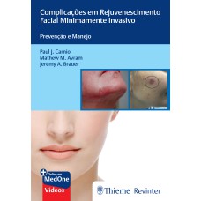 COMPLICAÇÕES EM REJUVENESCIMENTO FACIAL MINIMAMENTE INVASIVO: PREVENÇÃO E MANEJO