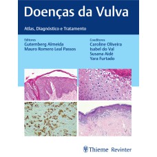 DOENÇAS DA VULVA: ATLAS, DIAGNÓSTICO E TRATAMENTO