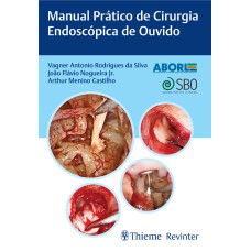 ABORL MANUAL PRÁTICO DE CIRURGIA ENDOSCÓPICA DE OUVIDO