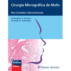 CIRURGIA MICROGRÁFICA DE MOHS: DAS CAMADAS À RECONSTRUÇÃO