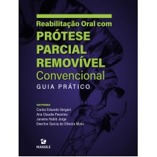 Reabilitação oral com prótese parcial removível convencional: guia prático