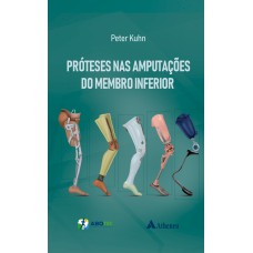 PRÓTESES NAS AMPUTAÇÕES DO MEMBRO INFERIOR