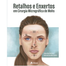 RETALHOS E ENXERTOS EM CIRURGIA MICROGRÁFICA DE MOHS