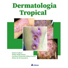 DERMATOLOGIA TROPICAL