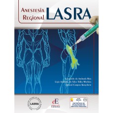 LASRA ANESTESIA REGIONAL