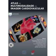 ATLAS DE MULTIMODALIDADE EM IMAGEM CARDIOVASCULAR