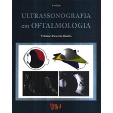 ULTRASSONOGRAFIA EM OFTALMOLOGIA