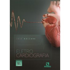 Eletrocardiografia