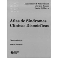 ATLAS DE SÍNDROMES CLÍNICAS DISMÓRFICAS