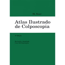 ATLAS ILUSTRADO DE COLPOSCOPIA