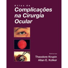 ATLAS DE COMPLICAÇÕES NA CIRURGIA OCULAR