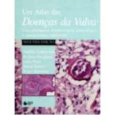 ATLAS DE DOENÇAS DA VULVA: UMA ABORDAGEM DERMATOLÓGICA, GINECOLÓGICA E VENEREOLÓGICA COMBINADA