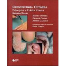 CRIOCIRURGIA CUTÂNEA: PRINCÍPIOS E PRÁTICA CLÍNICA