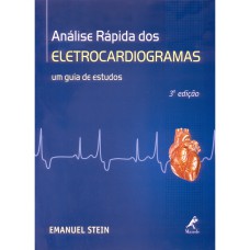 ANÁLISE RÁPIDA DOS ELETROCARDIOGRAMAS: UM GUIA DE ESTUDOS