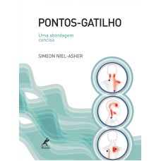 Pontos-gatilho: Uma abordagem concisa