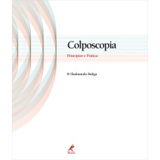 COLPOSCOPIA: PRINCÍPIOS E PRÁTICA