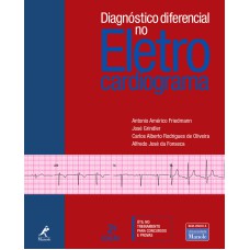 Diagnóstico diferencial no eletrocardiograma