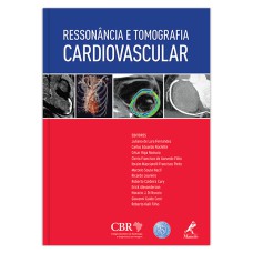 RESSONÂNCIA E TOMOGRAFIA CARDIOVASCULAR