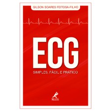 ECG simples, fácil e prático