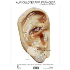 MAPA AURICULOTERAPIA FRANCESA