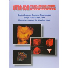 ULTRA-SOM TRIDIMENSIONAL - ATLAS COMENTADO