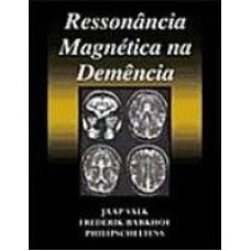 RESSONÂNCIA MAGNÉTICA NA DEMÊNCIA