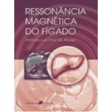 RESSONÂNCIA MAGNÉTICA DO FÍGADO