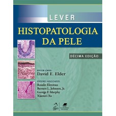 LEVER - HISTOPATOLOGIA DA PELE