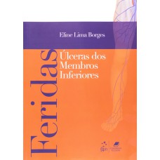 FERIDAS - ÚLCERAS DE MEMBROS INFERIORES