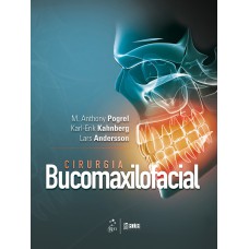 CIRURGIA BUCOMAXILOFACIAL