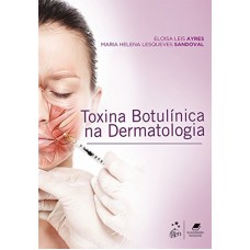 TOXINA BOTULINICA NA DERMATOLOGIA