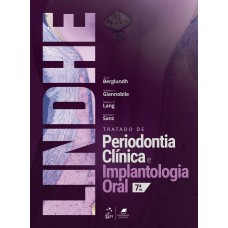 TRATADO DE PERIODONTIA CLINICA E IMPLANTOLOGIA ORAL