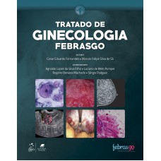 FEBRASGO - TRATADO DE GINECOLOGIA