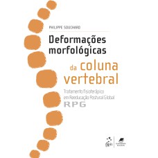 DEFORMAÇÕES MORFOLÓGICAS DA COLUNA VERTEBRAL - TRATAMENTO FISIOTERÁPICO EM REEDUCAÇÃO POSTURAL GLOBAL - RPG