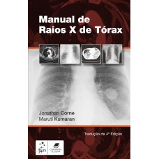 MANUAL DE RAIOS-X DE TÓRAX