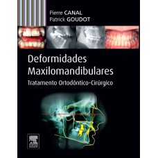 DEFORMIDADES MAXILO-MANDIBULARES