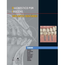 ESPECIALIDADES EM IMAGENS - IMPLANTES DENTÁRIOS