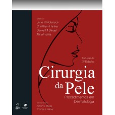 CIRURGIA DA PELE - PROCEDIMENTOS EM DERMATOLOGIA