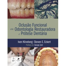 OCLUSÃO FUNCIONAL EM ODONTOLOGIA RESTAURADORA E PRÓTESE DENTÁRIA