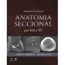 ANATOMIA SECCIONAL POR RM E TC