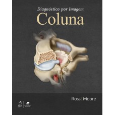 DIAGNÓSTICO POR IMAGEM: COLUNA